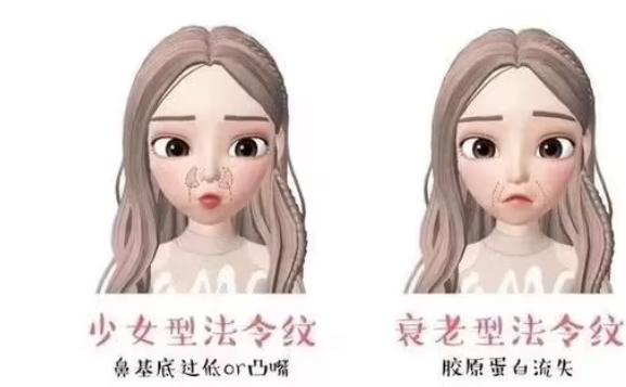 法令紋常見類型都有哪些？法令紋預防方法
